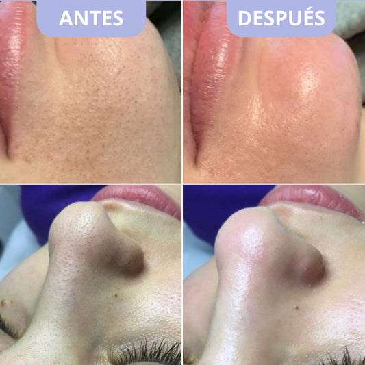 Exfoliante Arroz Blanco + Arroz  Negro Gratis